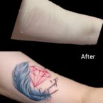 傷口のカバータトゥー_20241222