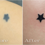 リメイクタトゥー_20250802