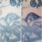 復元タトゥー_20260110
